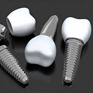 Dental Implants in Port Washington